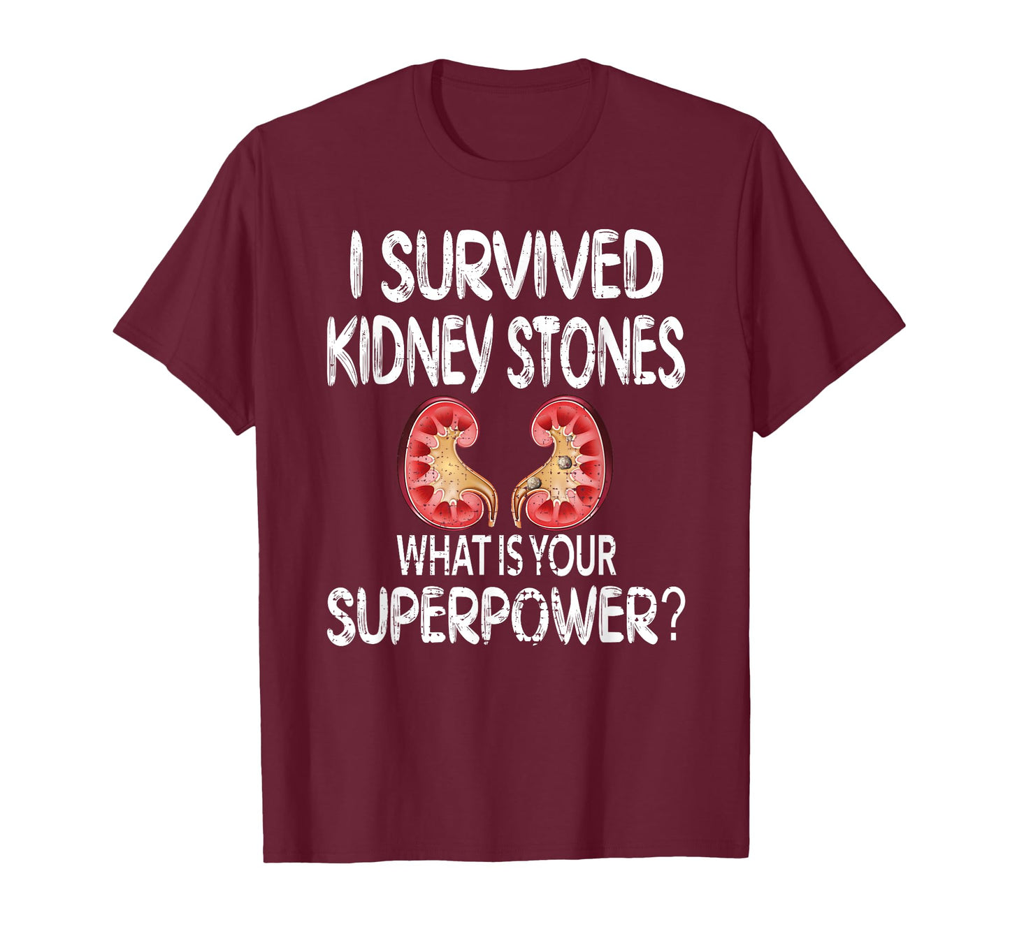 I Survived Kidney Stones Kidney Stone Recovery T-Shirt