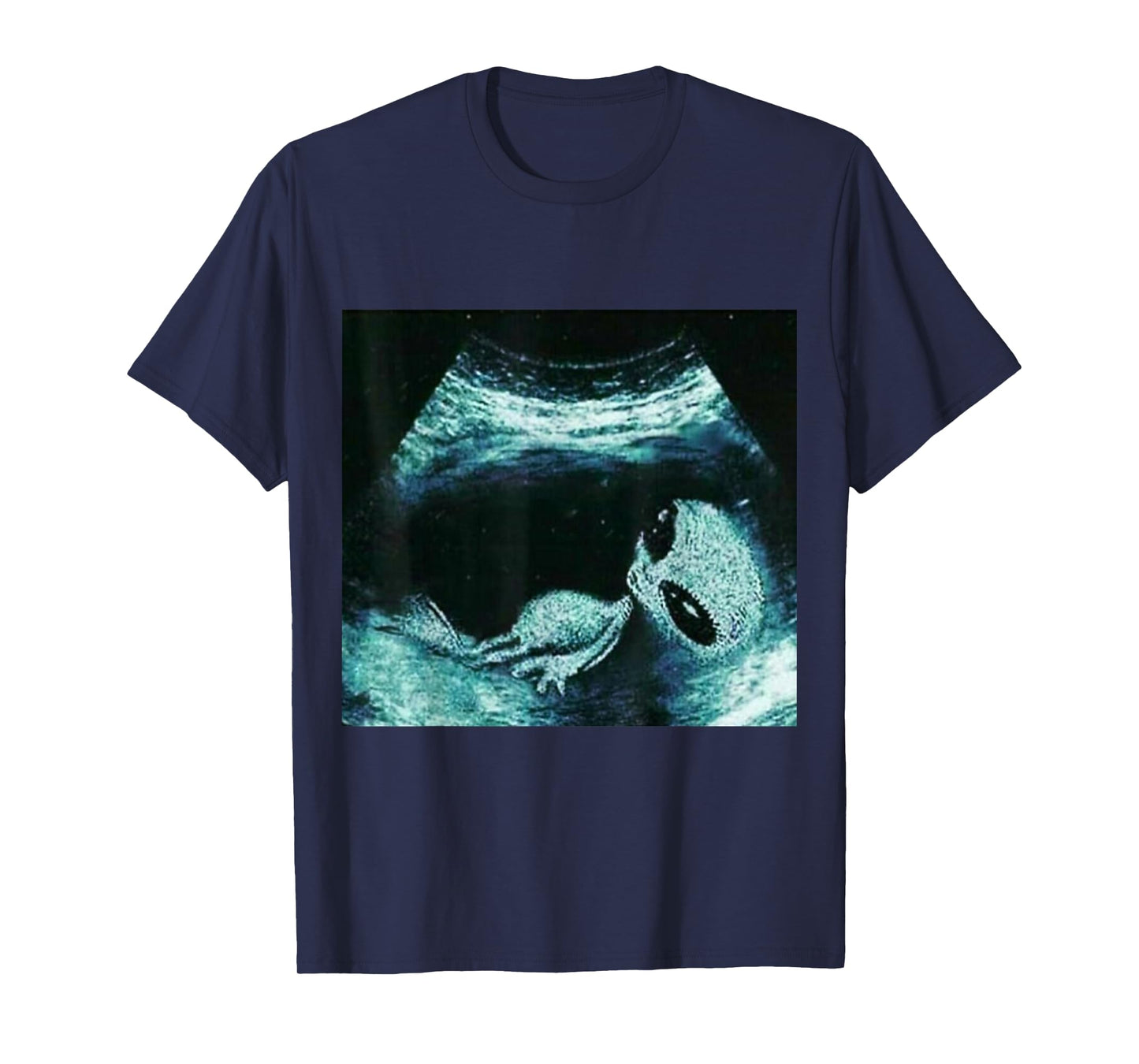 Funny Alien Xray Meme Brainrot T-Shirt